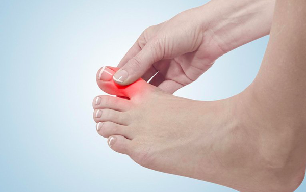 bệnh gút có dùng được đông trùng hạ thảo không