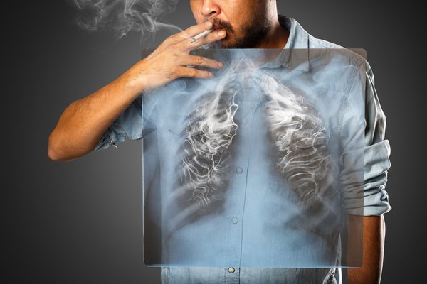 Tuổi và giới tính ảnh hưởng rất nhiều trong quá trình điều trị