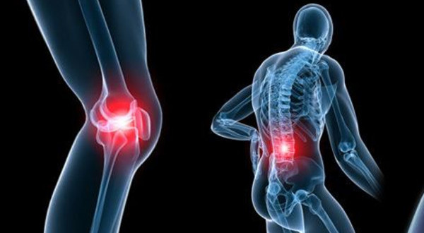 Ung thư phổi di căn xương là giai đoạn cuối của bệnh Ung thư phổi di căn xương là giai đoạn cuối của bệnh