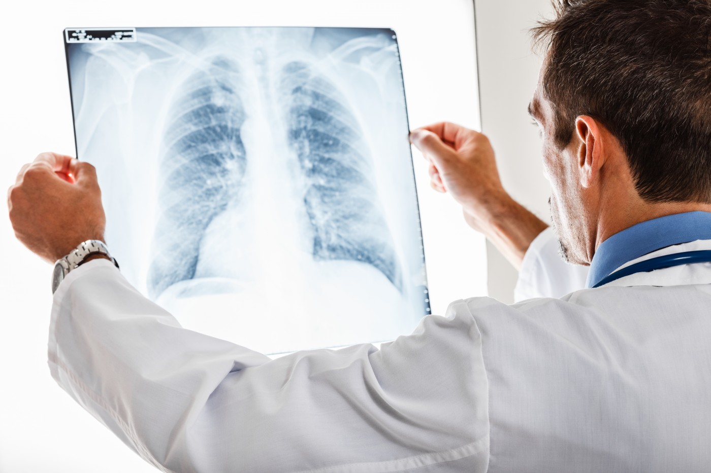 Các phương pháp điều trị giúp tăng tuổi thọ cho người bệnh Các phương pháp điều trị giúp tăng tuổi thọ cho người bệnh